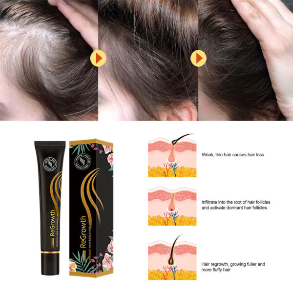 Regrowth Organic Hair Serum Roller Set Hair Care Anti Stripping Liquid Suitable For All Types Of Hair Loss Scalp Nourishing - Image 6