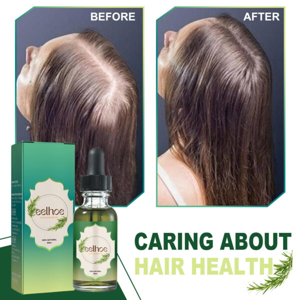 Nourishing Anti-hair Loss Thick Hair Care - Image 4