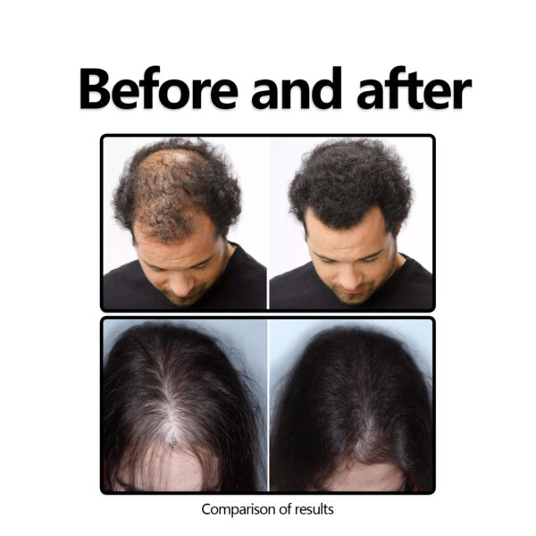 Herbal Hair Care Solution Anti-hair Loss And Strong - Image 2